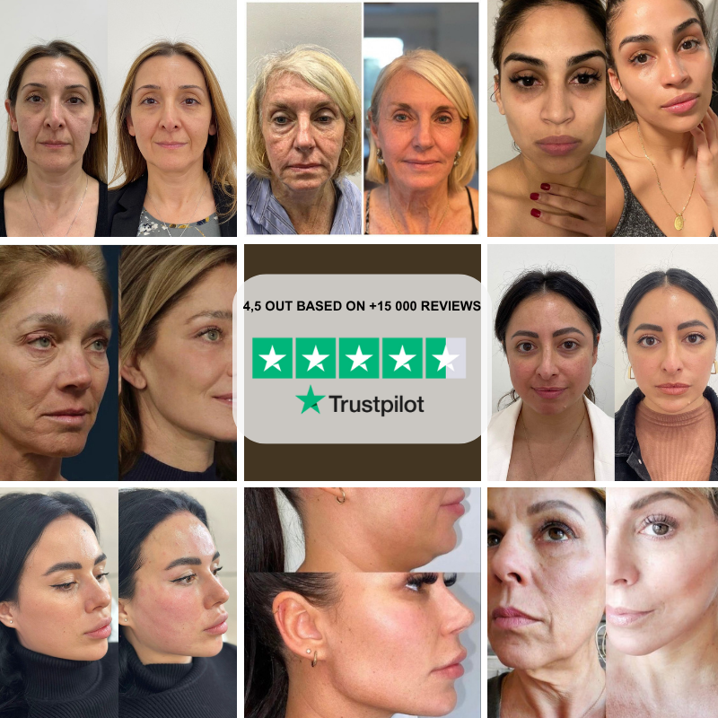 Lunux™ - Contour Brush